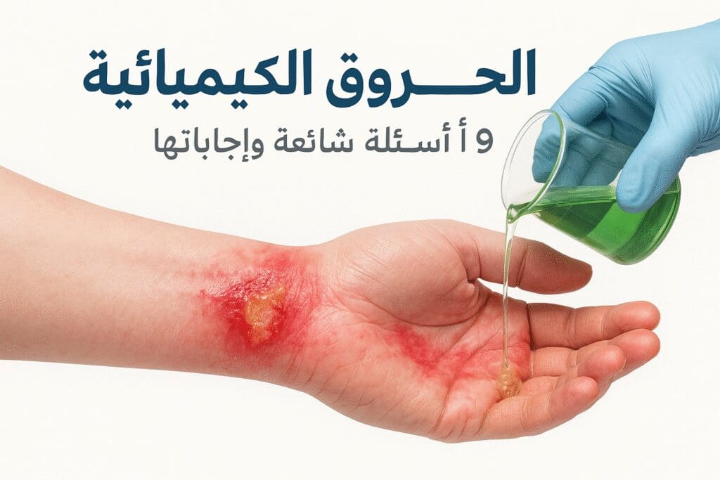 الحروق الكيميائية 9 أسئلة شائعة وإجاباتها