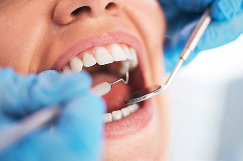 Oral and maxillofacial surgery in Türkiye