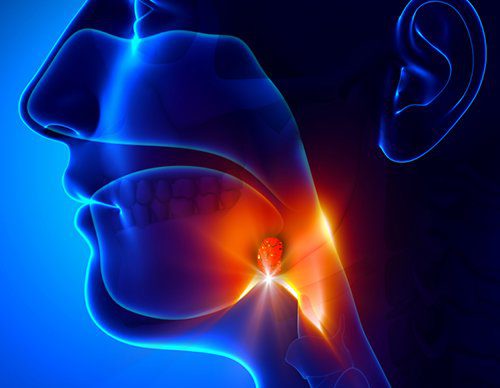 Throat cancer treatment in Türkiye