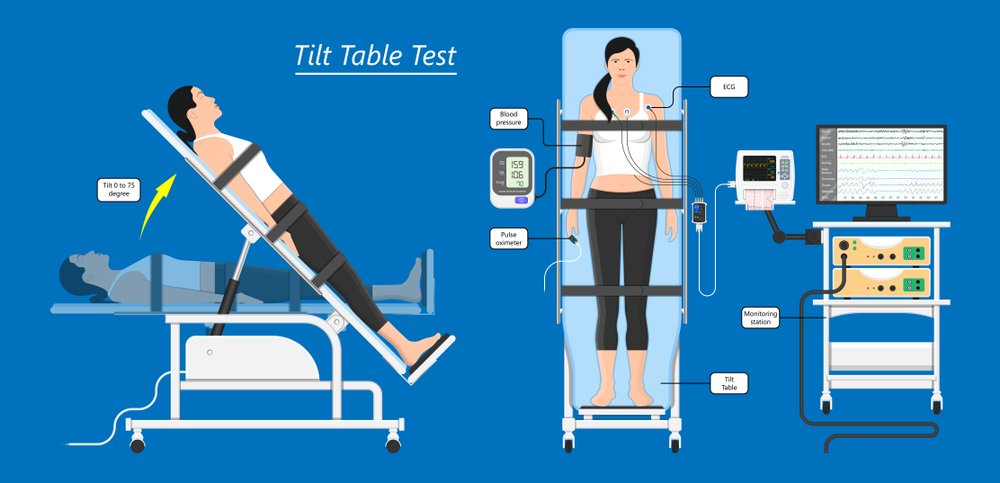 Tilt table test in Türkiye