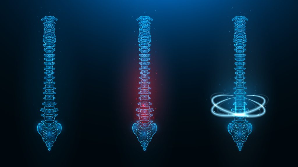 What is Complex Spinal Reconstruction?