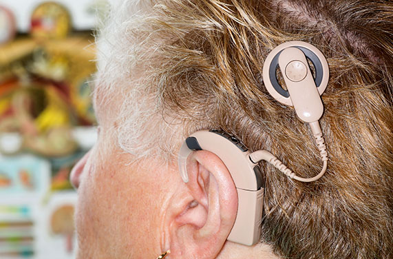 Cochlear Implant Surgery