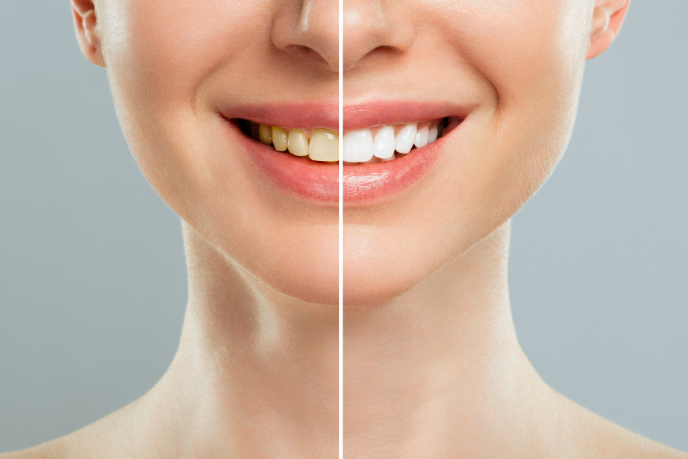 Are same-day dental implants suitable for you?