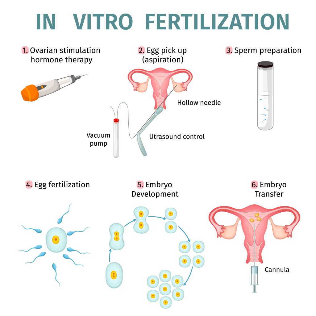 IVF | In Vitro Fertilization