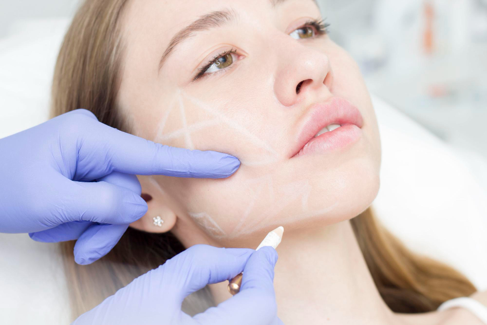 What are the benefits of cheek filler?