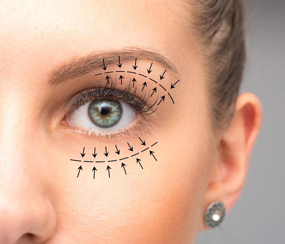 Eyelid surgery, or blepharoplasty Treatment Methods