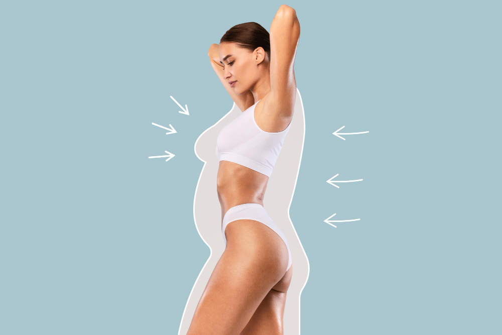 Panniculectomy Surgery: Procedure | Candidate | Recovery