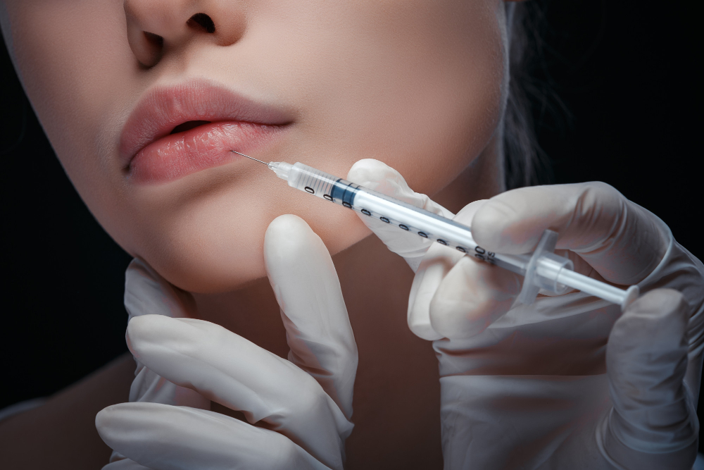Lip Augmentation | Types of Lip lift & Injections and Fillers