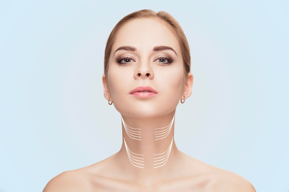 Neck Lift (Platysmaplasty)