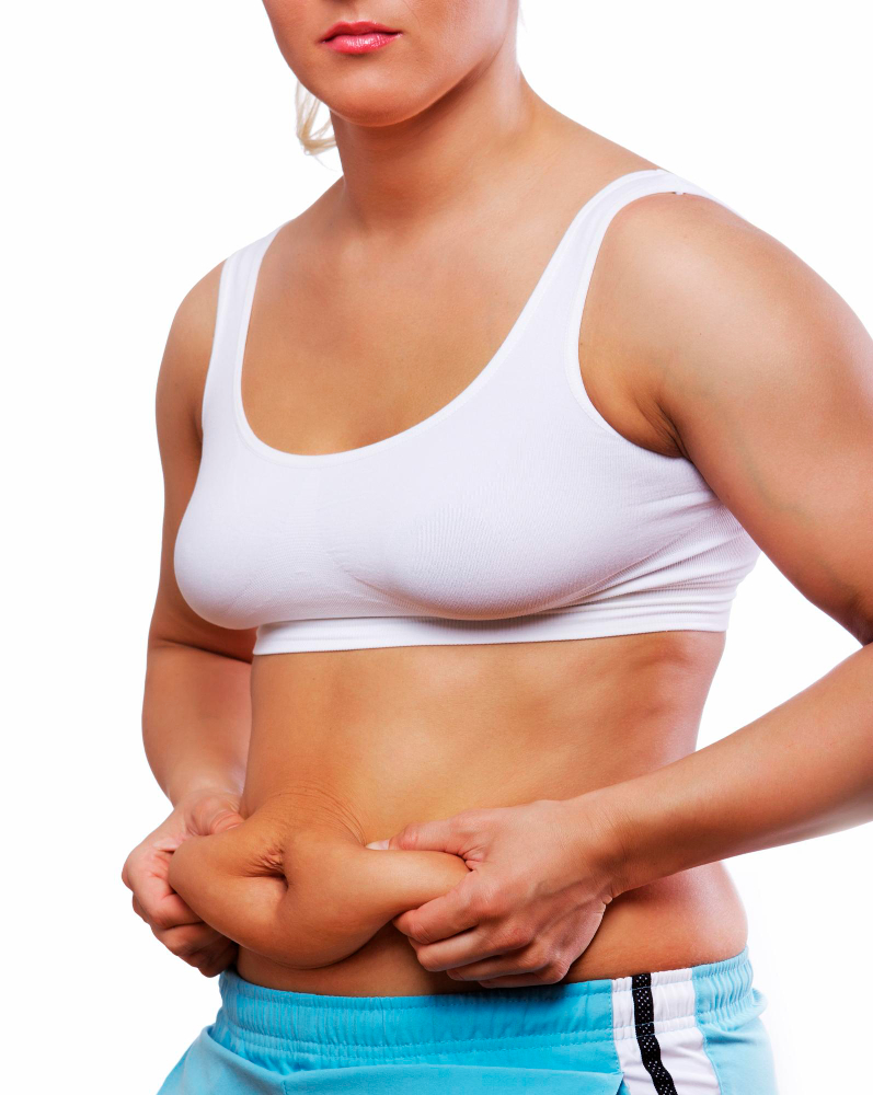 Panniculectomy Surgery: Procedure | Candidate | Recovery