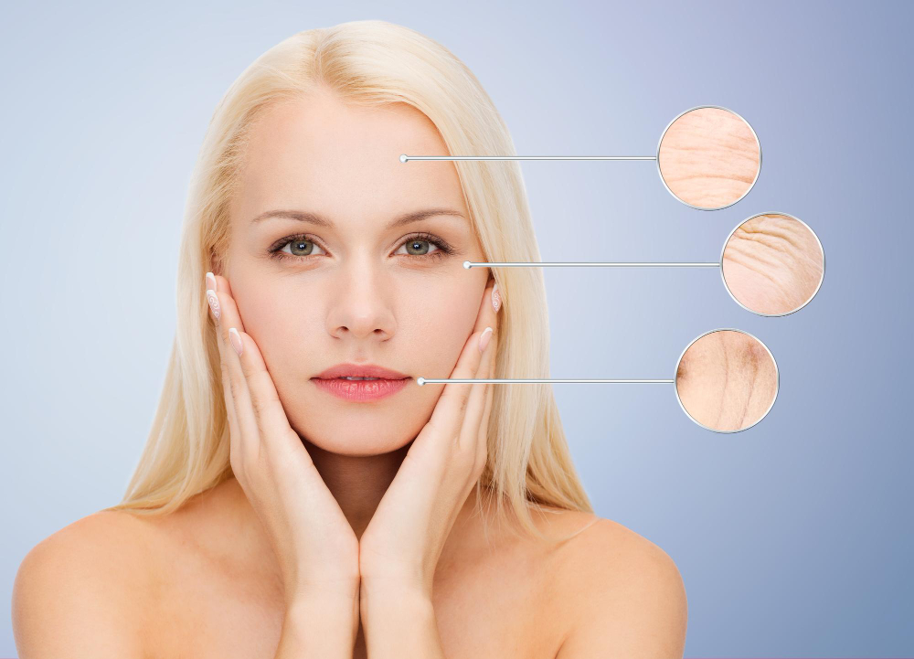 What is skin tightening?