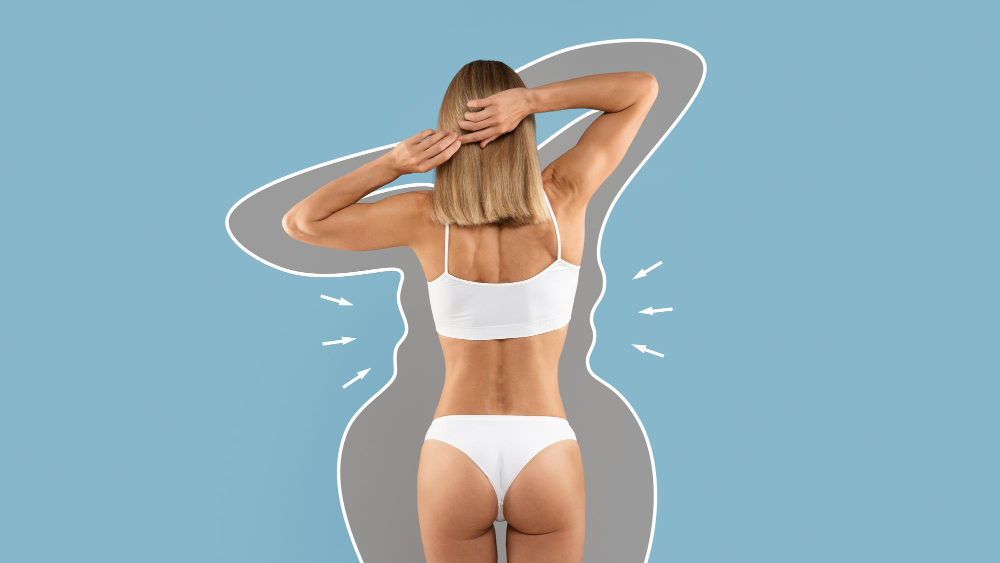 Upper Body Lift (Upper Trunkplasty)