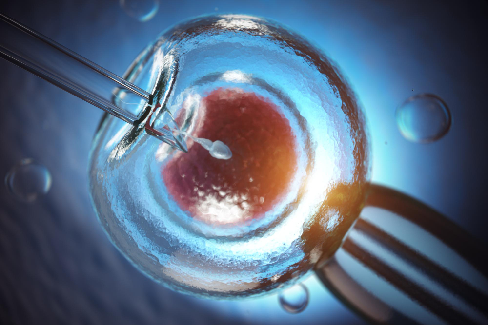 IVF (In Vitro Fertilization)