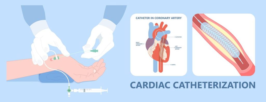 Cardiac Catheterization