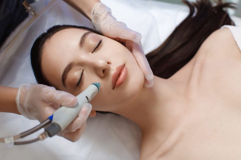 What is dermabrasion?