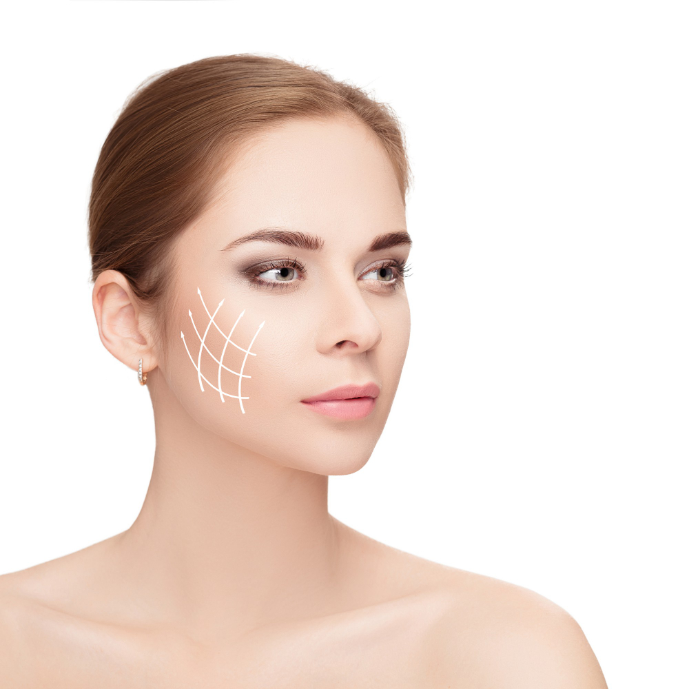 CHEEK AUGMENTATION (Cheek Implants)