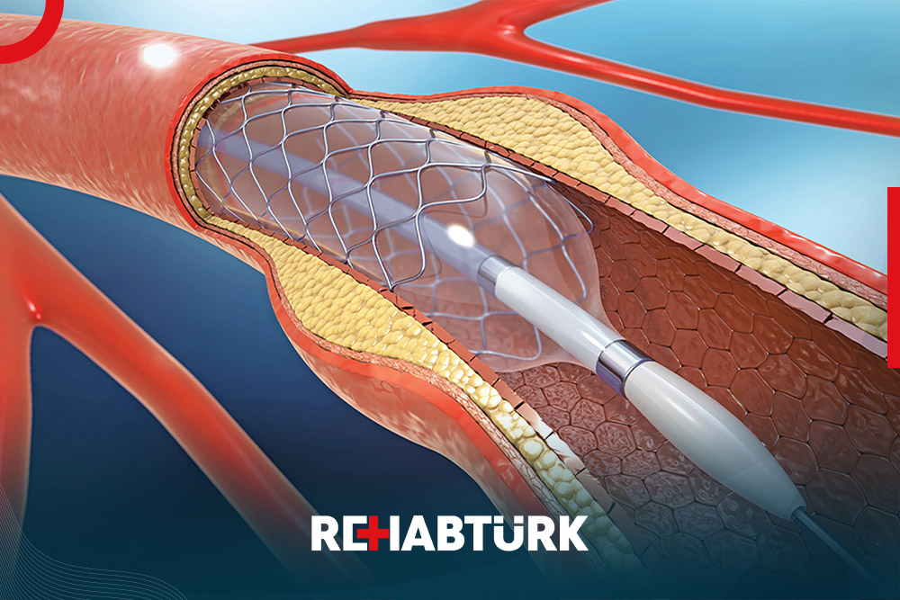 Cardiac catheterization in Türkiye