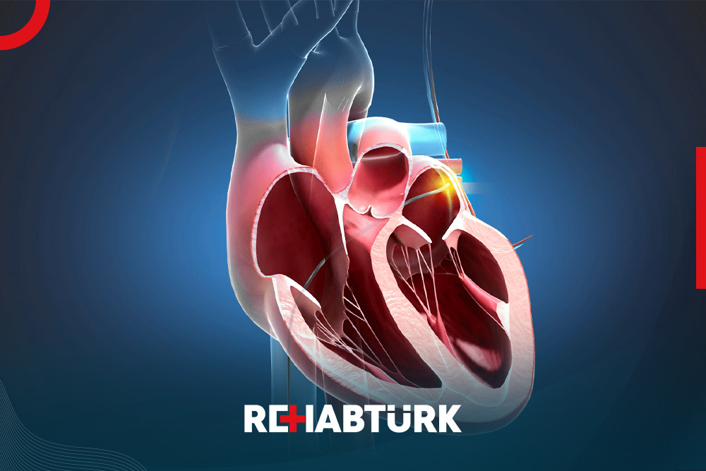 Catheter ablation in Türkiye