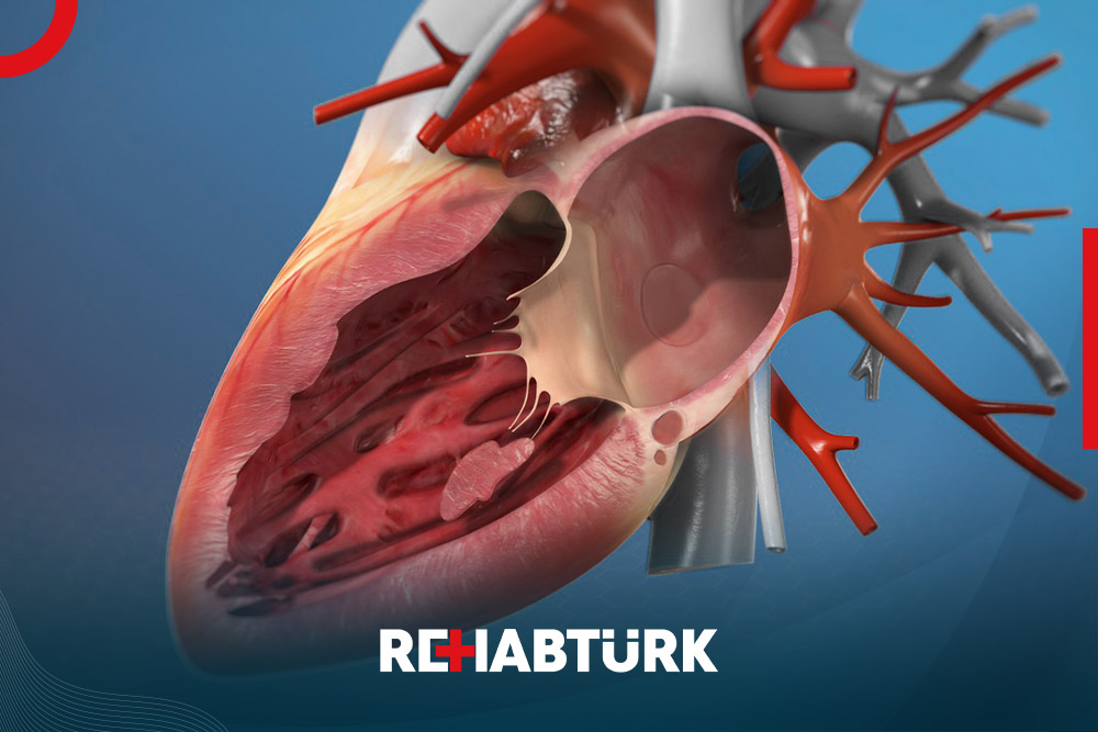 Heart valve repair surgery in Türkiye