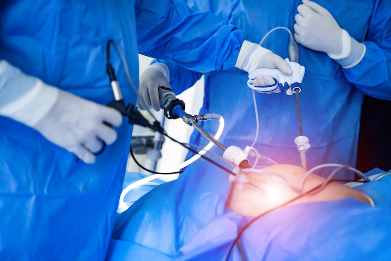 What is a laparoscopic cholecystectomy?