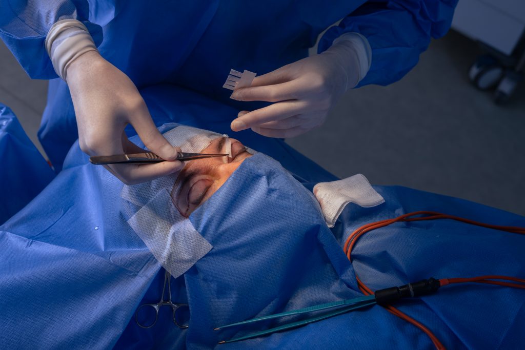 Eye Bag Surgery: What You Need to Know?