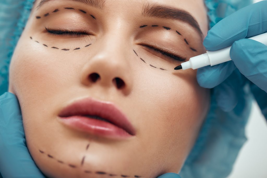 Eye Bag Surgery: What You Need to Know?