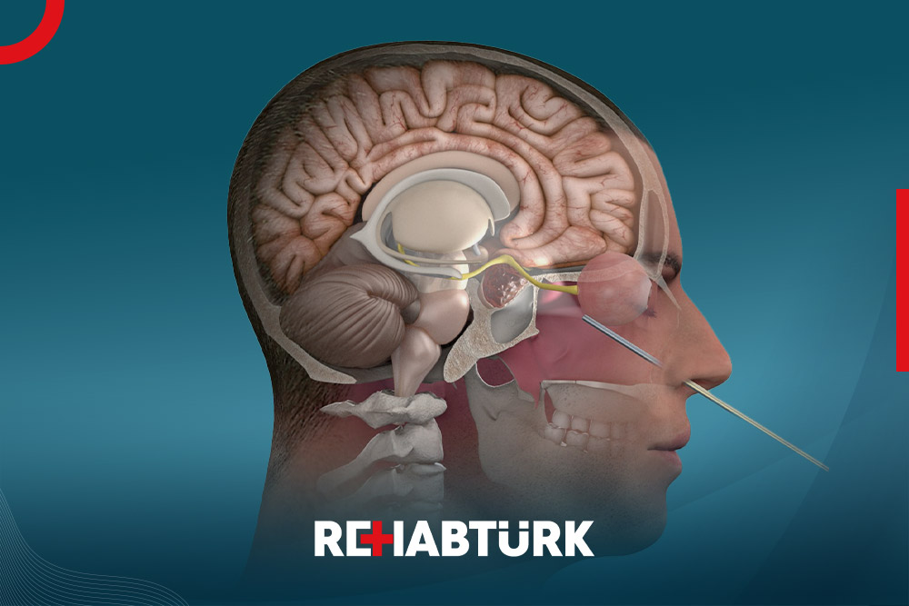 Laparoscopic pituitary surgery to remove tumors in Türkiye