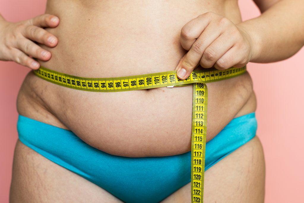 What is bariatric surgery?