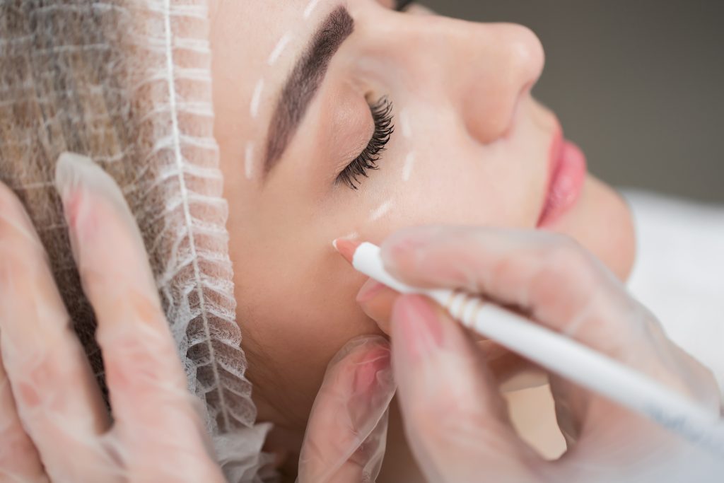 Eye Bag Surgery: What You Need to Know?