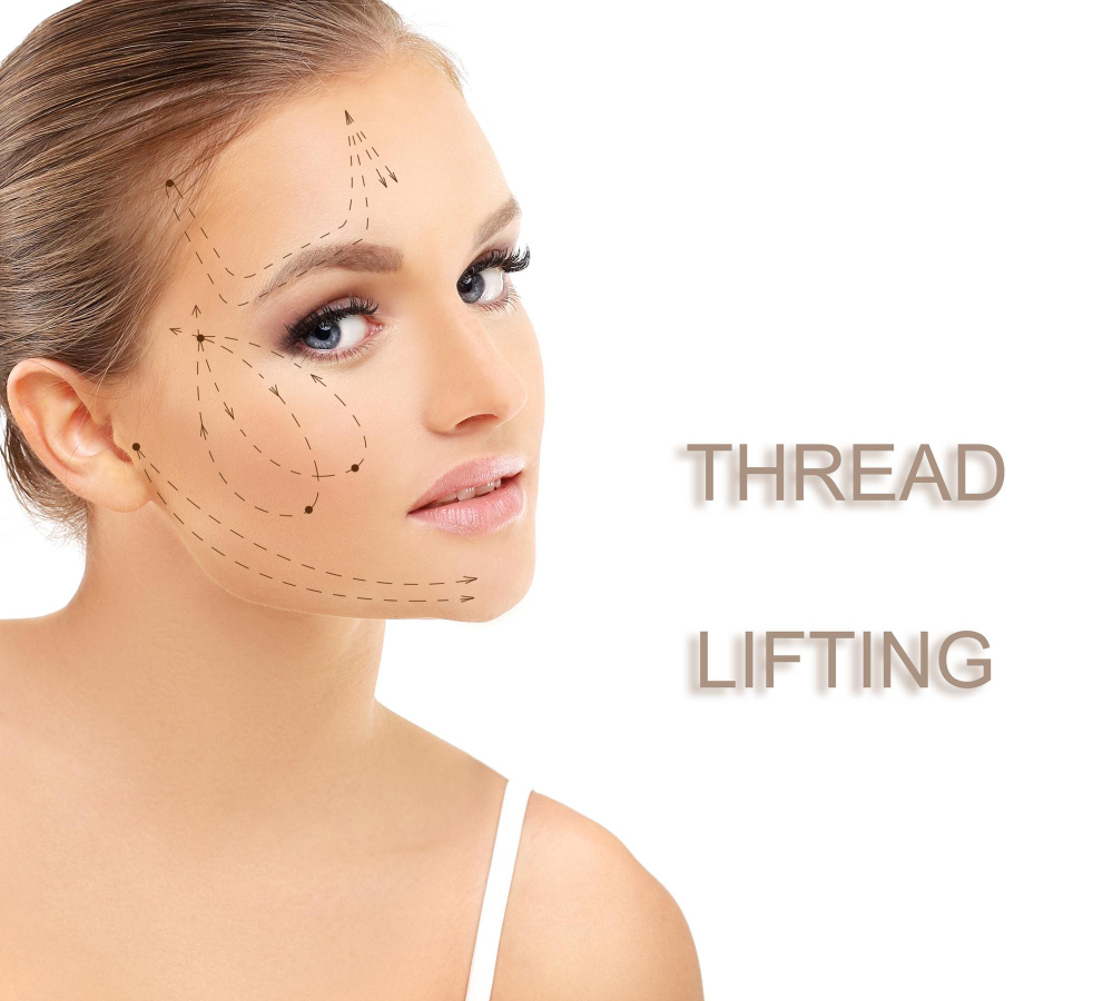 What Is A Thread Lift?