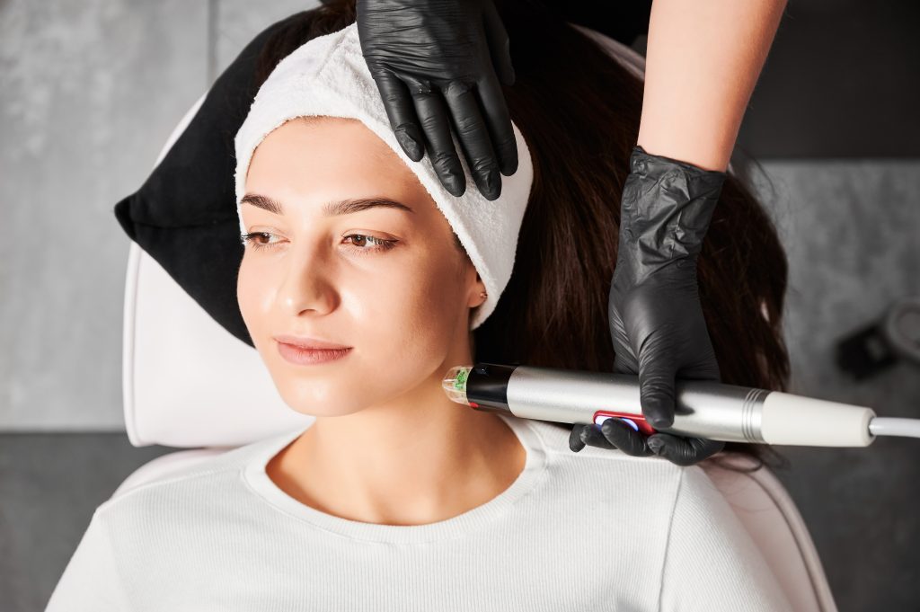 What is microneedling with PRP?