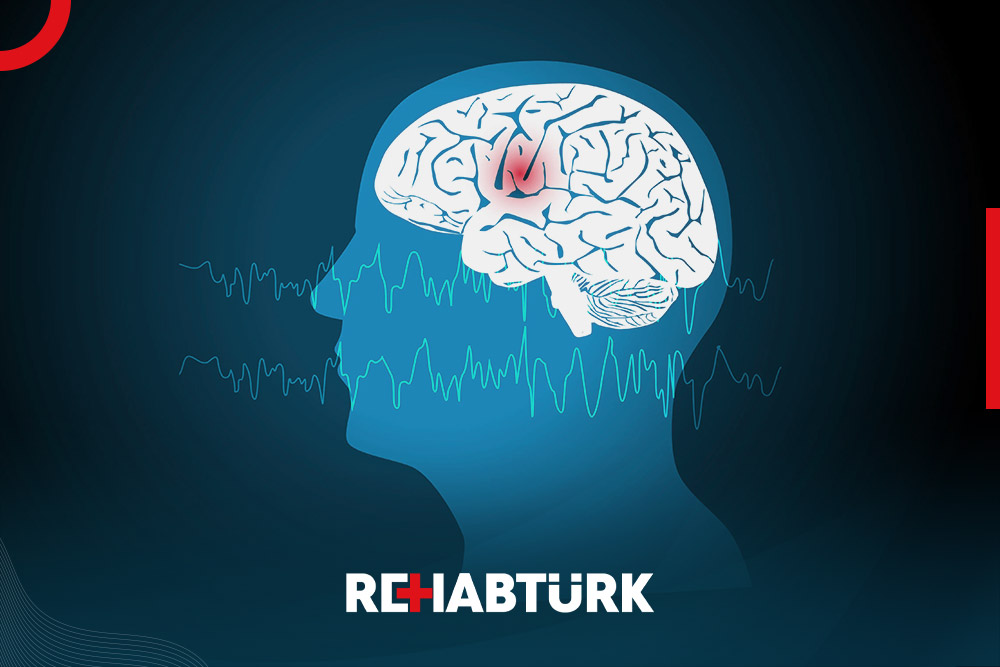 Migraine treatment in Türkiye (migraine)