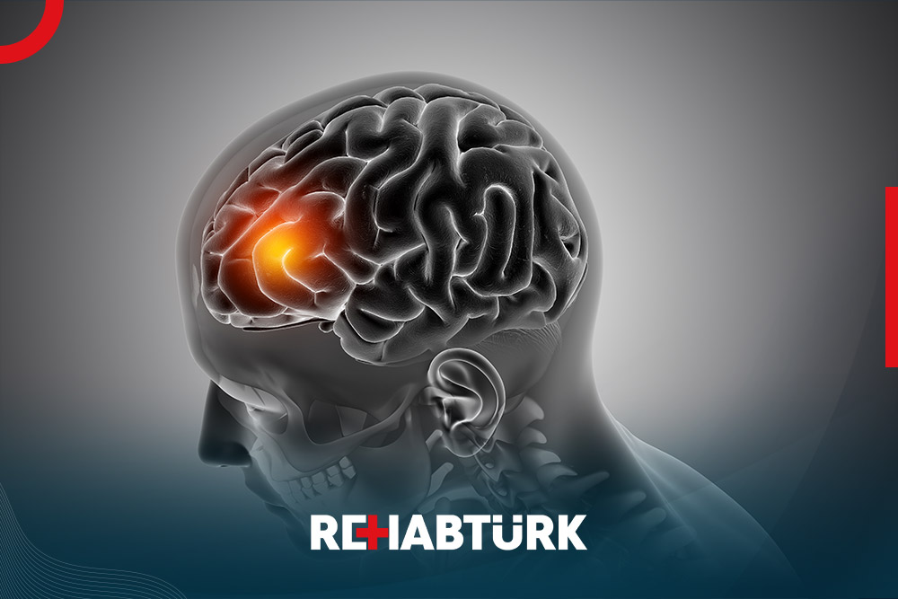 Epilepsy operation in Türkiye