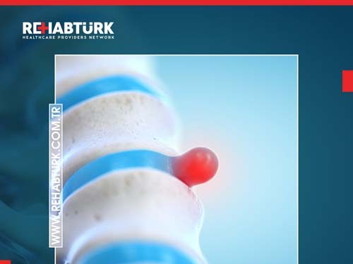 Herniated disc treatment in Türkiye