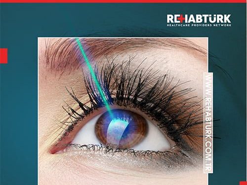 Cataract surgery by laser in Türkiye