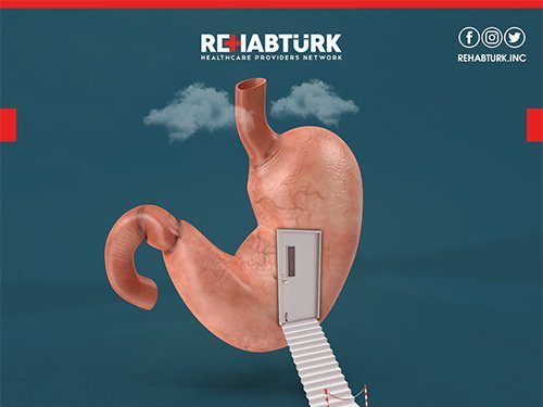 Sleeve gastrectomy in Türkiye
