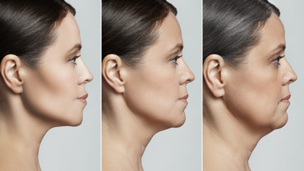 What Is Facial Contouring Surgery?