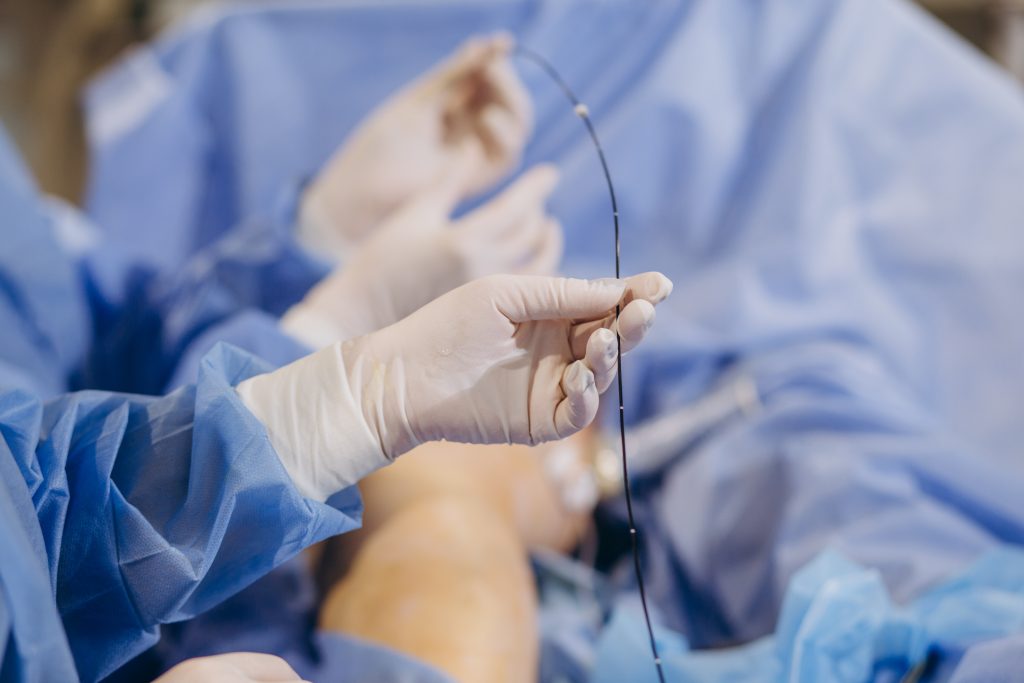 What is angioplasty?