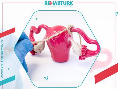 Reversal of laparoscopic tubal ligation in Türkiye