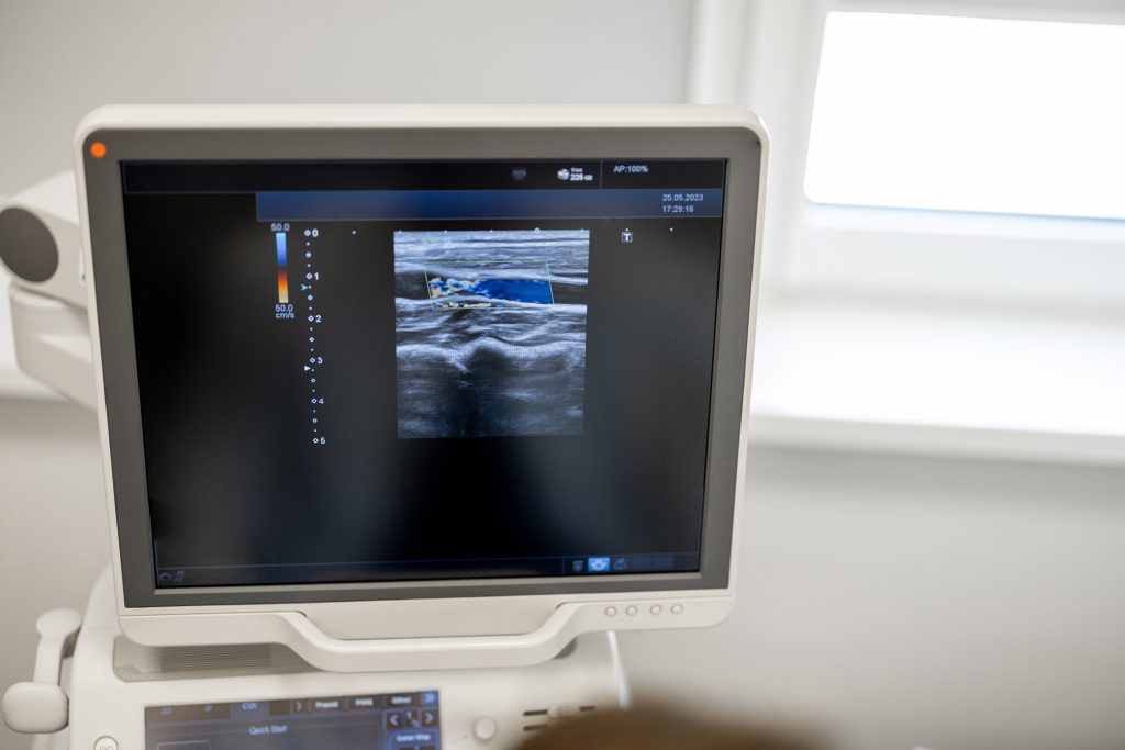 What is angioplasty?
