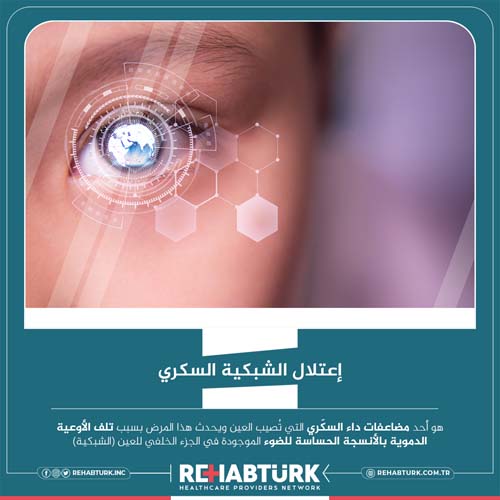 Лечение диабетической ретинопатии в Турции