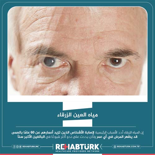 Лечение глаукомы глаза (глаукомы) в Турции