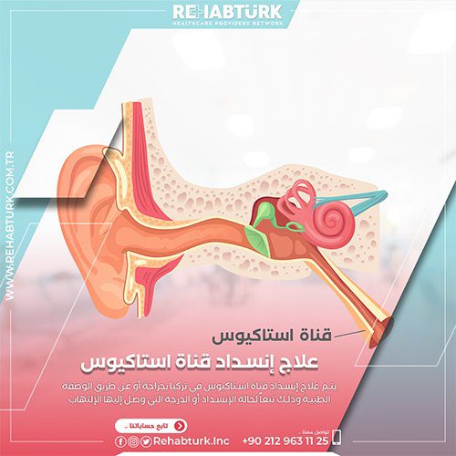 Лечение непроходимости евстахиевой трубы в Турции