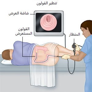 Процедура колоноскопии в Турции