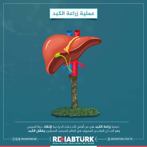 زراعة الكبد في تركيا
