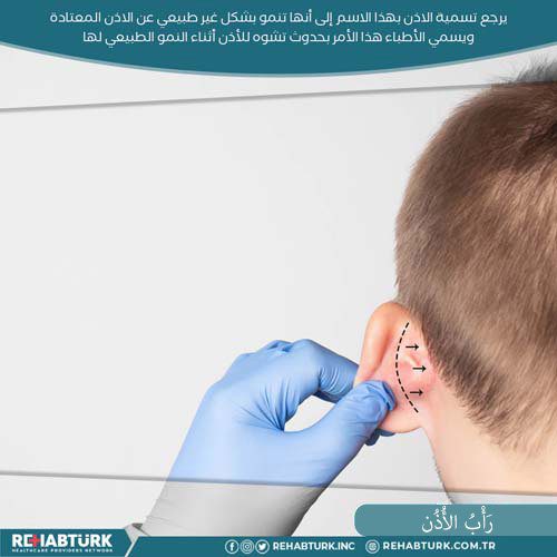 عملية تجميل الأذن في تركيا