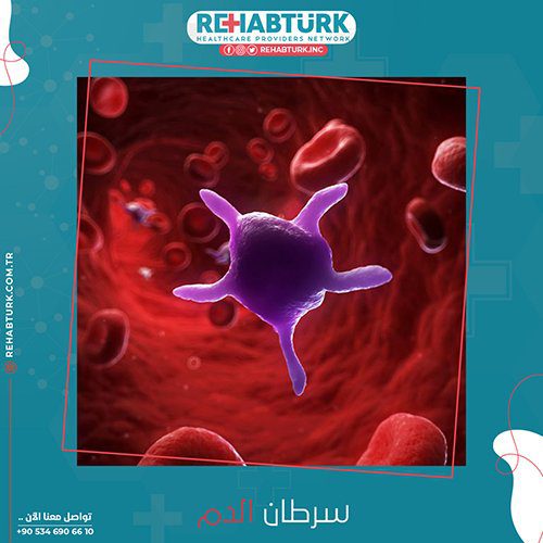علاج سرطان الدم في تركيا