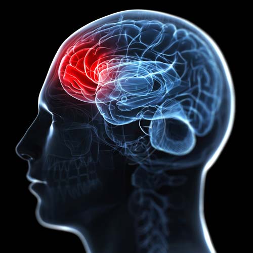 كيفية التعرف على نوبة نقص التروية العابرة أو السكتة الدماغية – وماذا يجب فعله!!