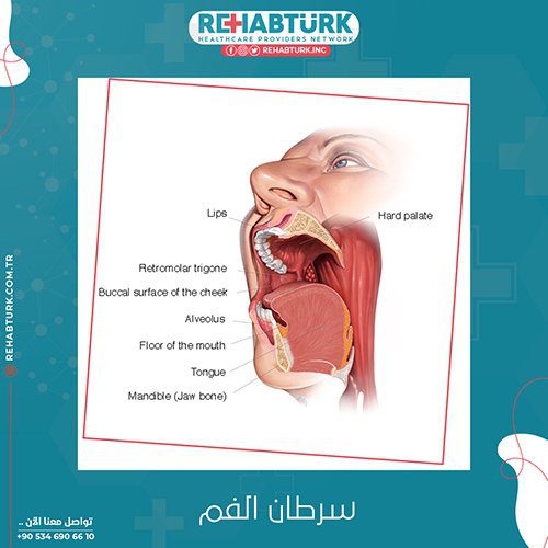 علاج سرطان الفم في تركيا