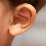 التهاب الأذن الوسطى الحاد